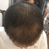 發(fā)際線用戶圖片