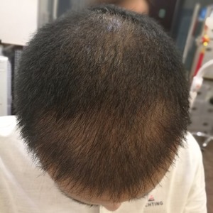 发际线分享社区