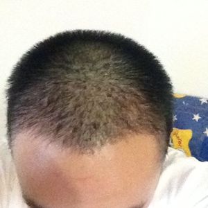 发际线分享社区