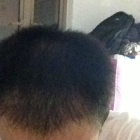 發(fā)際線用戶圖片