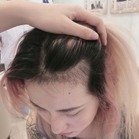 發(fā)際線用戶圖片