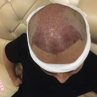 發(fā)際線用戶圖片