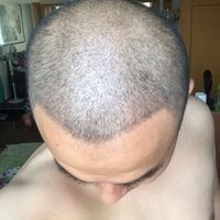 發(fā)際線用戶圖片
