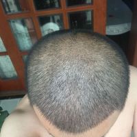 發(fā)際線用戶圖片
