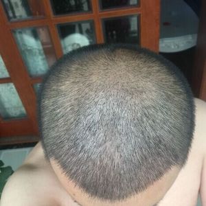 发际线分享社区