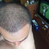 發(fā)際線用戶圖片