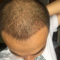 發(fā)際線用戶圖片