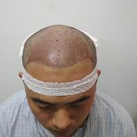 發(fā)際線用戶圖片