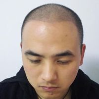 發(fā)際線用戶圖片