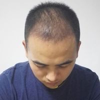 發(fā)際線用戶圖片