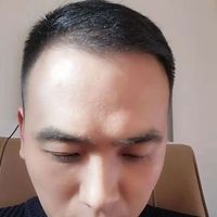 發(fā)際線用戶圖片