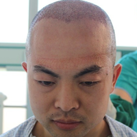 發(fā)際線用戶圖片