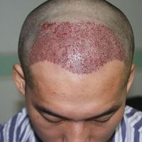 發(fā)際線用戶圖片