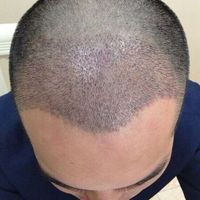 發(fā)際線用戶圖片
