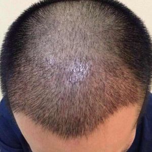 发际线分享社区