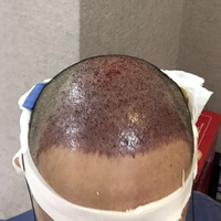 發(fā)際線用戶圖片