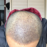 發(fā)際線用戶圖片
