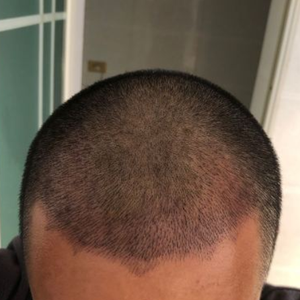 发际线分享社区