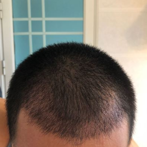 发际线分享社区