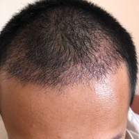 發(fā)際線用戶圖片