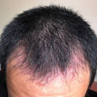 發(fā)際線用戶圖片