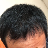 發(fā)際線用戶圖片