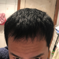 發(fā)際線用戶圖片