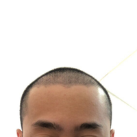 發(fā)際線用戶圖片