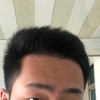 發(fā)際線用戶圖片