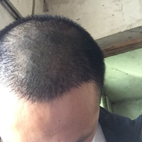 發(fā)際線用戶圖片