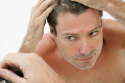 发际线调整手术特点是什么 发际线种植术是如何做的