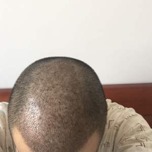发际线分享社区