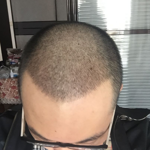 发际线分享社区
