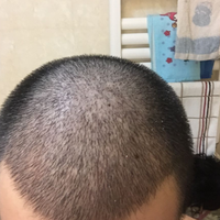 發(fā)際線用戶圖片