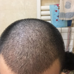 发际线分享社区