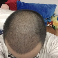 發(fā)際線用戶圖片