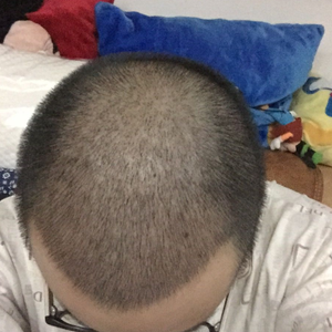 发际线分享社区