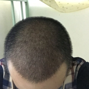 发际线分享社区