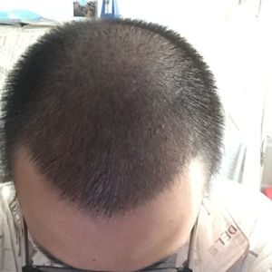 发际线分享社区