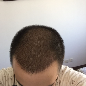 发际线分享社区