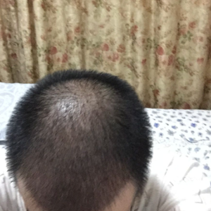发际线分享社区