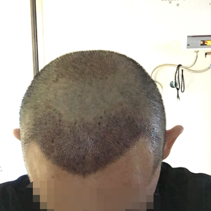 发际线分享社区
