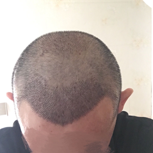 发际线分享社区