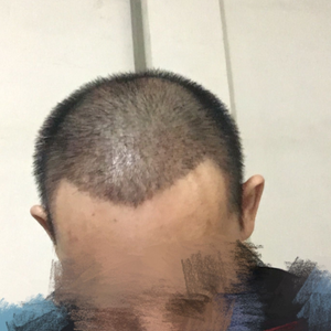 发际线分享社区