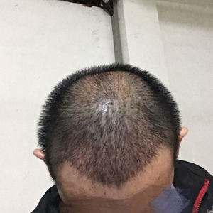 发际线分享社区