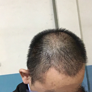 发际线分享社区