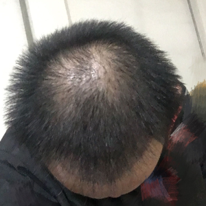 发际线分享社区