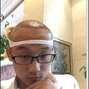 发际线分享社区