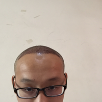 發(fā)際線用戶圖片