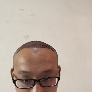 发际线分享社区